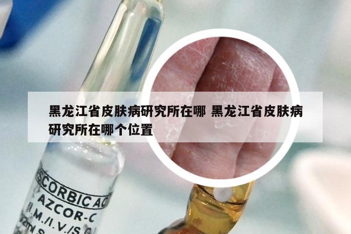 黑龙江省皮肤病研究所在哪 黑龙江省皮肤病研究所在哪个位置