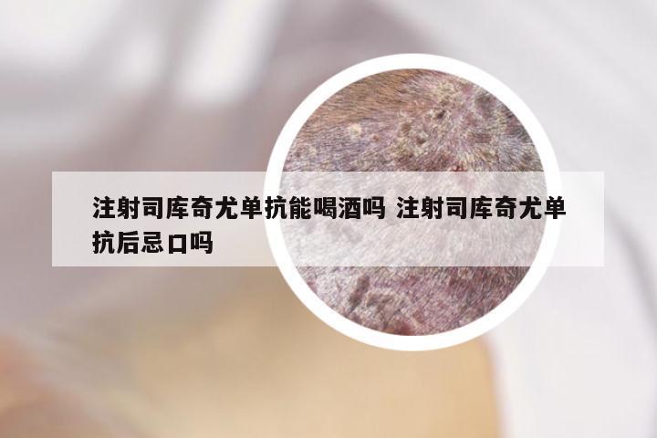 注射司库奇尤单抗能喝酒吗 注射司库奇尤单抗后忌口吗