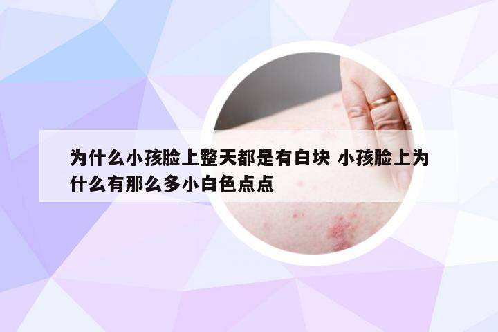 为什么小孩脸上整天都是有白块 小孩脸上为什么有那么多小白色点点