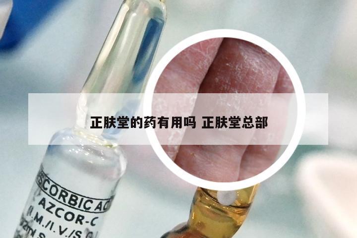 正肤堂的药有用吗 正肤堂总部