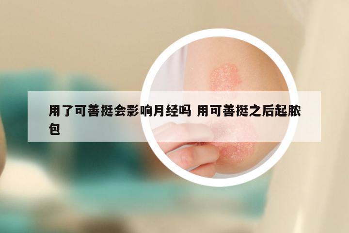 用了可善挺会影响月经吗 用可善挺之后起脓包