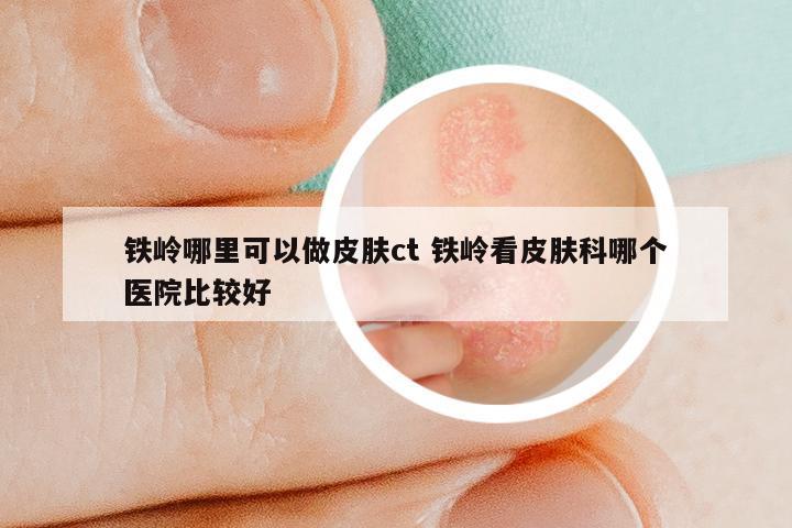 铁岭哪里可以做皮肤ct 铁岭看皮肤科哪个医院比较好