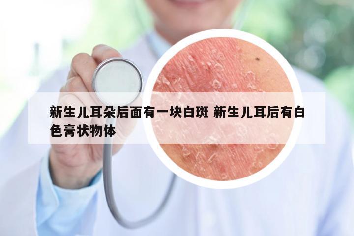 新生儿耳朵后面有一块白斑 新生儿耳后有白色膏状物体