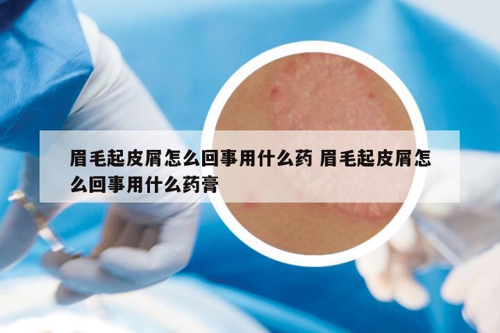 眉毛起皮屑怎么回事用什么药 眉毛起皮屑怎么回事用什么药膏