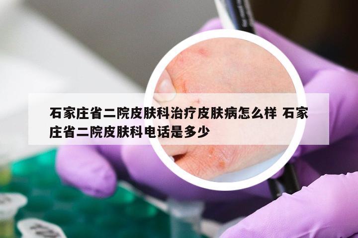 石家庄省二院皮肤科治疗皮肤病怎么样 石家庄省二院皮肤科电话是多少