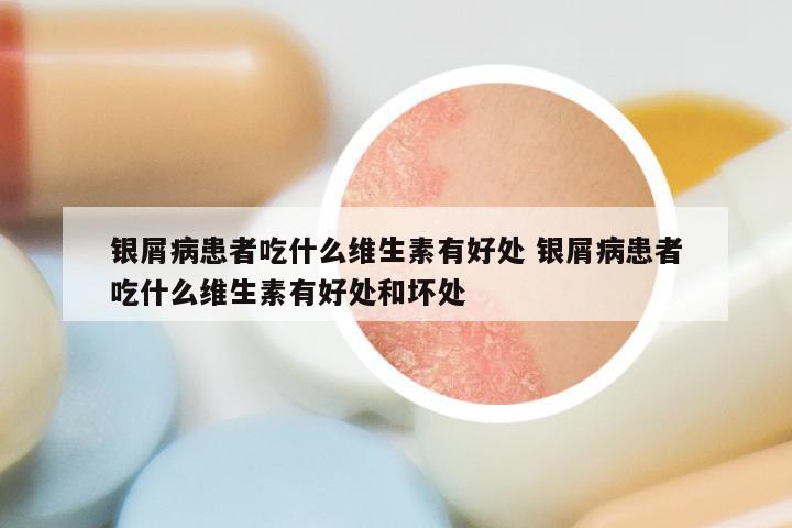 银屑病患者吃什么维生素有好处 银屑病患者吃什么维生素有好处和坏处