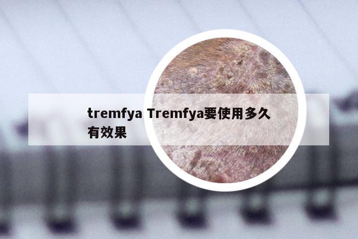 tremfya Tremfya要使用多久有效果