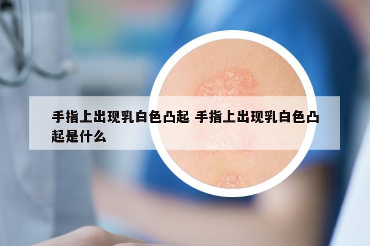 手指上出现乳白色凸起 手指上出现乳白色凸起是什么