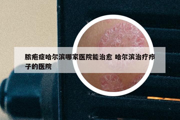 脓疱症哈尔滨哪家医院能治愈 哈尔滨治疗疖子的医院