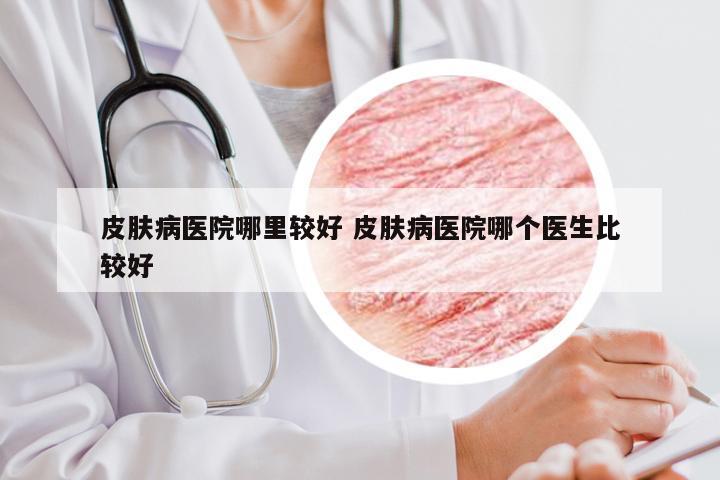 皮肤病医院哪里较好 皮肤病医院哪个医生比较好