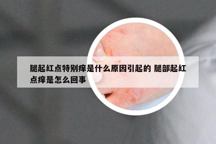 腿起红点特别痒是什么原因引起的 腿部起红点痒是怎么回事