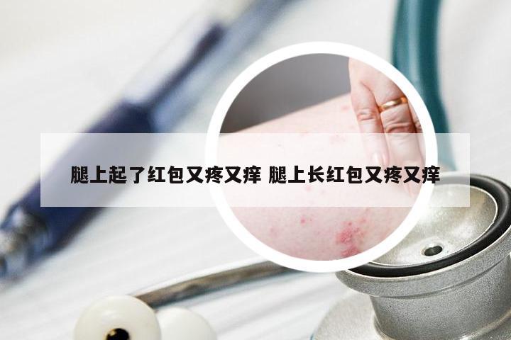 腿上起了红包又疼又痒 腿上长红包又疼又痒