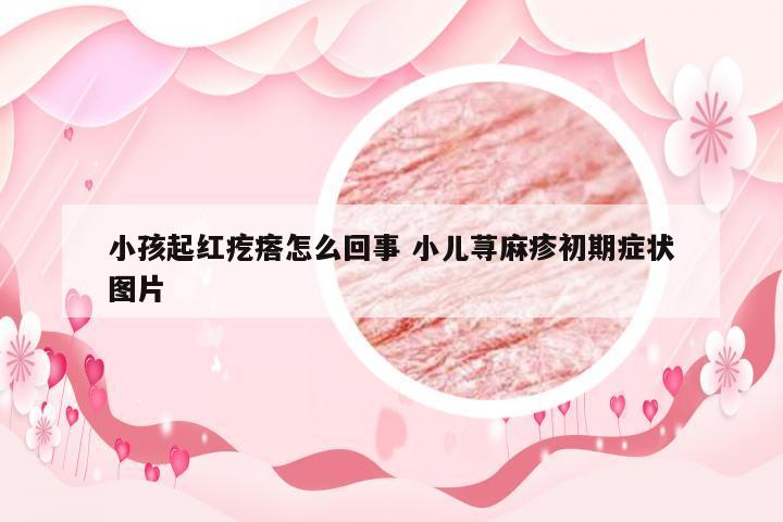 小孩起红疙瘩怎么回事 小儿荨麻疹初期症状图片