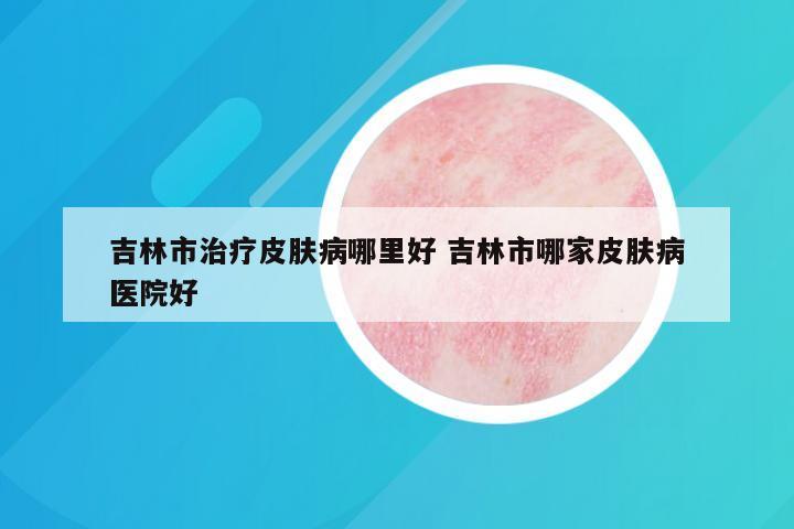 吉林市治疗皮肤病哪里好 吉林市哪家皮肤病医院好