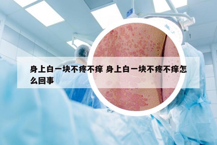 身上白一块不疼不痒 身上白一块不疼不痒怎么回事