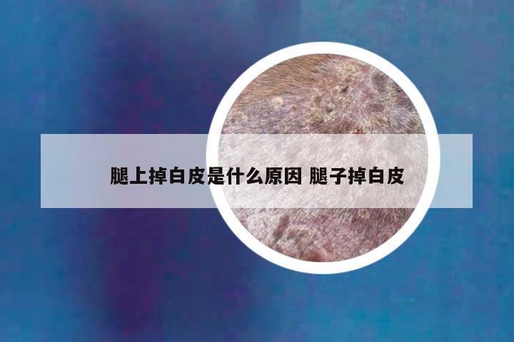 腿上掉白皮是什么原因 腿子掉白皮