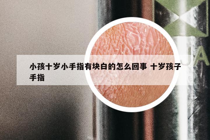 小孩十岁小手指有块白的怎么回事 十岁孩子手指