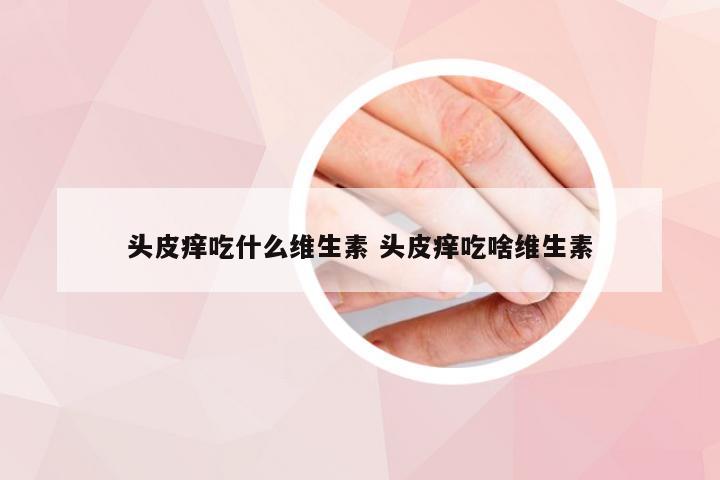 头皮痒吃什么维生素 头皮痒吃啥维生素