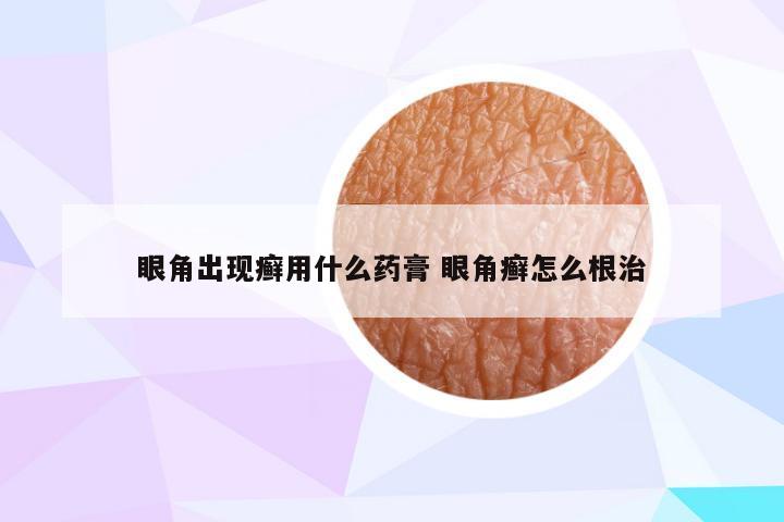 眼角出现癣用什么药膏 眼角癣怎么根治