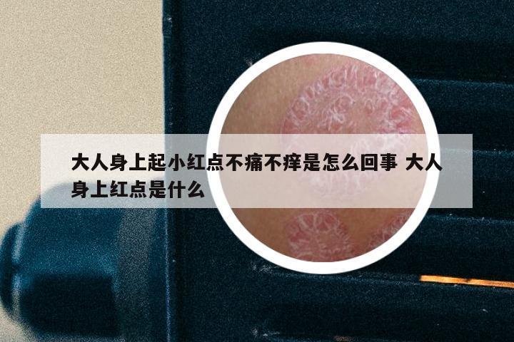 大人身上起小红点不痛不痒是怎么回事 大人身上红点是什么