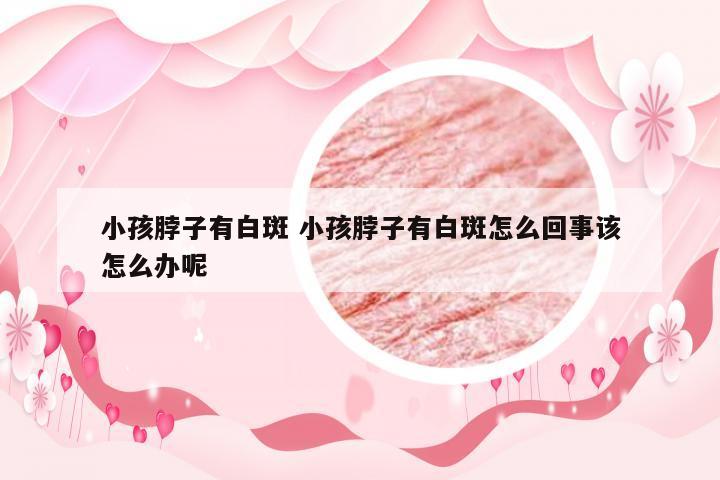 小孩脖子有白斑 小孩脖子有白斑怎么回事该怎么办呢