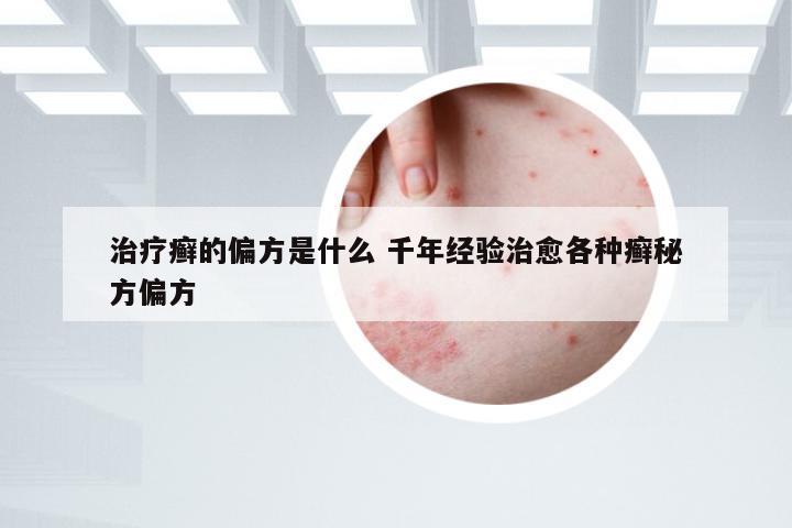 治疗癣的偏方是什么 千年经验治愈各种癣秘方偏方