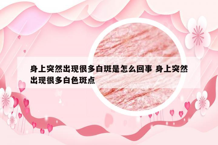 身上突然出现很多白斑是怎么回事 身上突然出现很多白色斑点