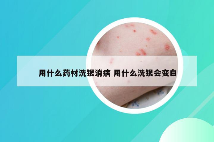 用什么药材洗银消病 用什么洗银会变白