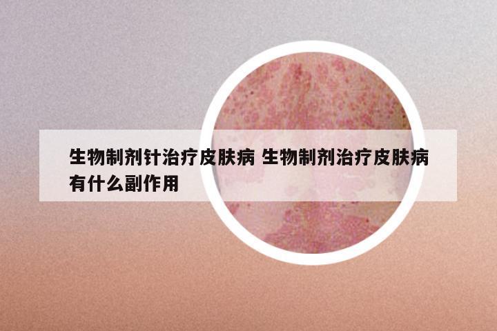 生物制剂针治疗皮肤病 生物制剂治疗皮肤病有什么副作用