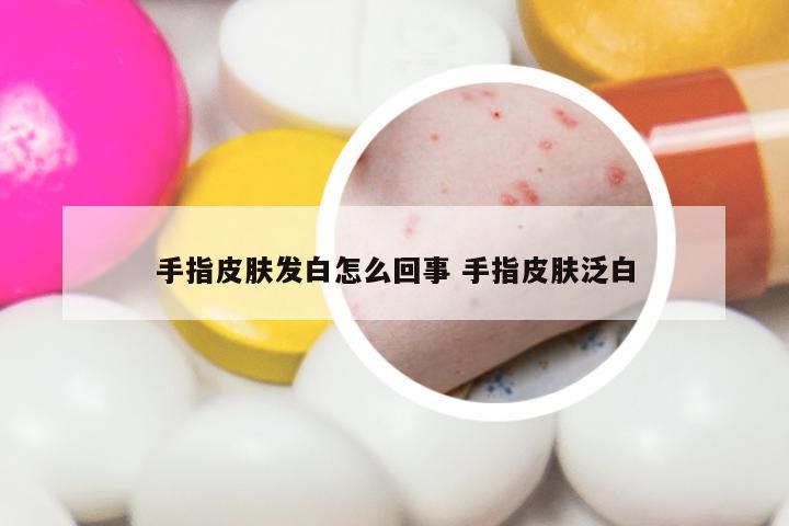 手指皮肤发白怎么回事 手指皮肤泛白