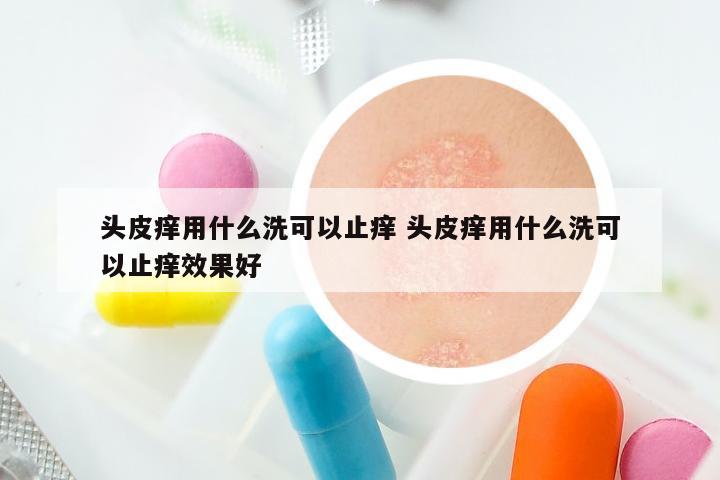 头皮痒用什么洗可以止痒 头皮痒用什么洗可以止痒效果好