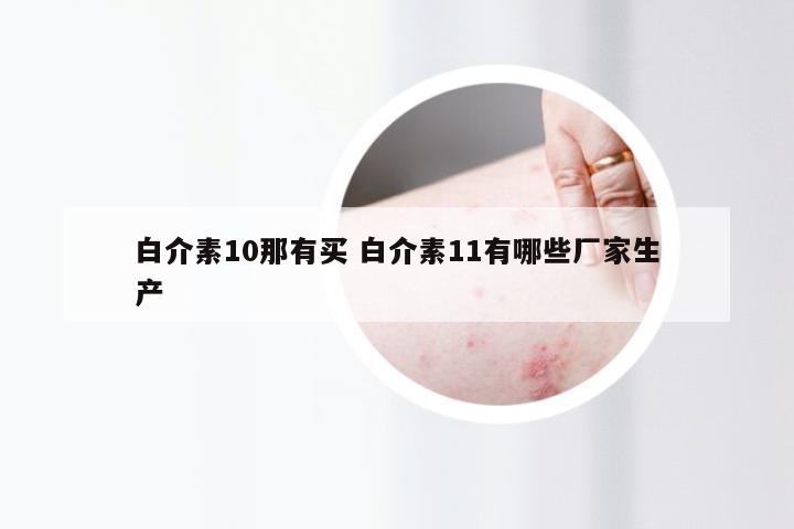 白介素10那有买 白介素11有哪些厂家生产