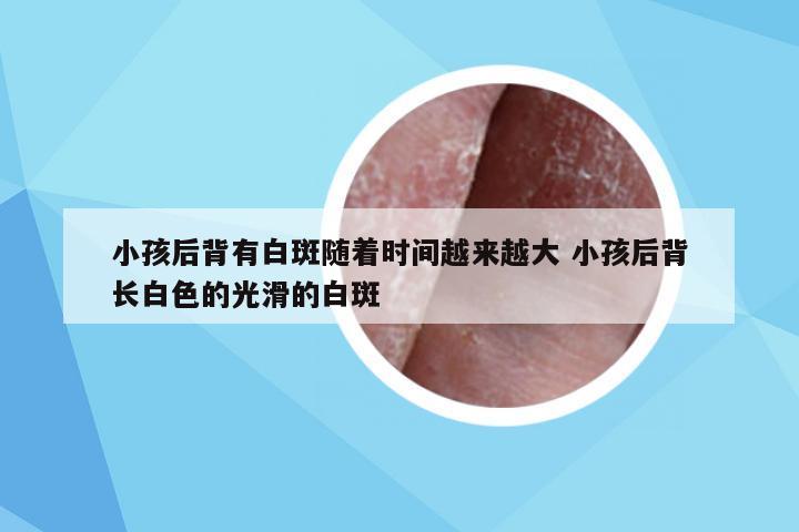 小孩后背有白斑随着时间越来越大 小孩后背长白色的光滑的白斑