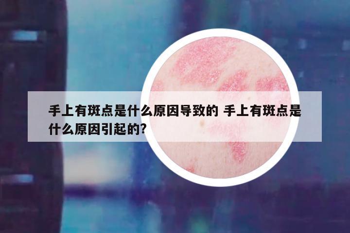 手上有斑点是什么原因导致的 手上有斑点是什么原因引起的?