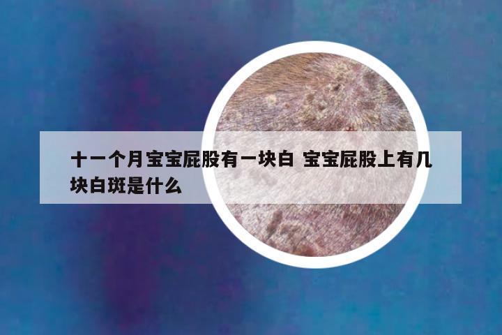 十一个月宝宝屁股有一块白 宝宝屁股上有几块白斑是什么