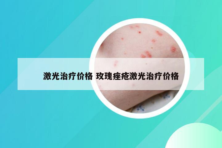 激光治疗价格 玫瑰痤疮激光治疗价格