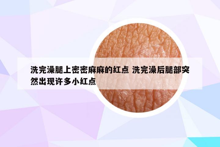 洗完澡腿上密密麻麻的红点 洗完澡后腿部突然出现许多小红点