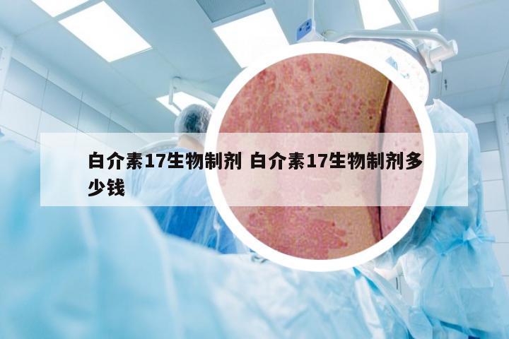 白介素17生物制剂 白介素17生物制剂多少钱