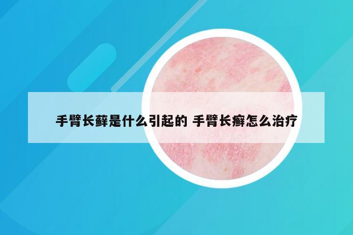 手臂长藓是什么引起的 手臂长癣怎么治疗