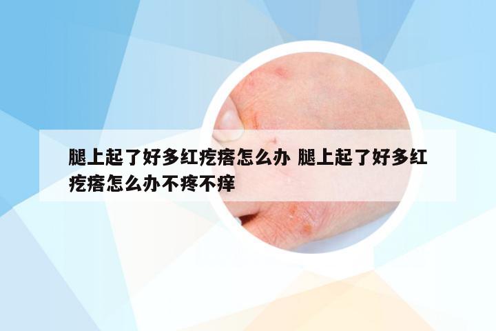 腿上起了好多红疙瘩怎么办 腿上起了好多红疙瘩怎么办不疼不痒