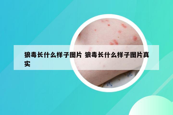 狼毒长什么样子图片 狼毒长什么样子图片真实