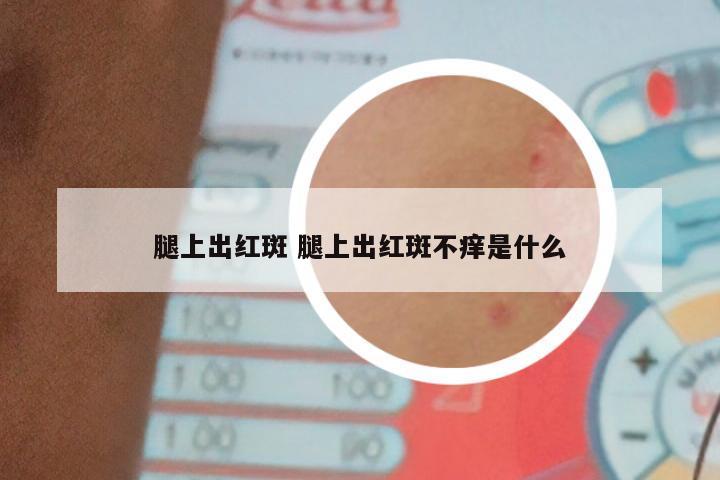 腿上出红斑 腿上出红斑不痒是什么