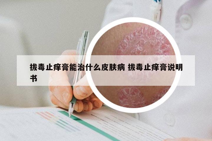 拔毒止痒膏能治什么皮肤病 拔毒止痒膏说明书