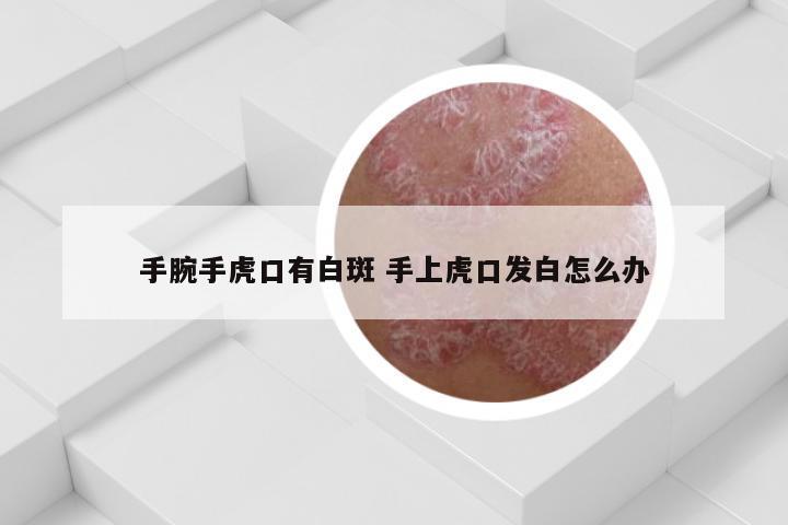 手腕手虎口有白斑 手上虎口发白怎么办