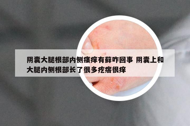 阴囊大腿根部内侧瘙痒有藓咋回事 阴囊上和大腿内侧根部长了很多疙瘩很痒