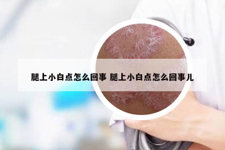 腿上小白点怎么回事 腿上小白点怎么回事儿