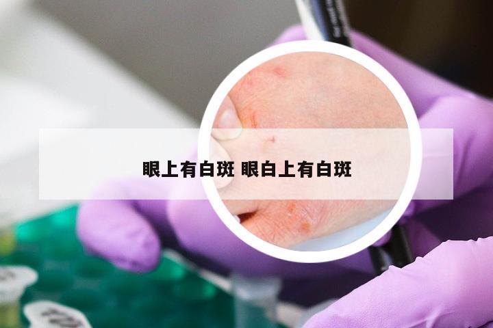 眼上有白斑 眼白上有白斑