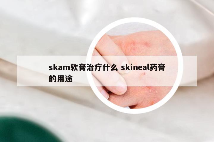 skam软膏治疗什么 skineal药膏的用途