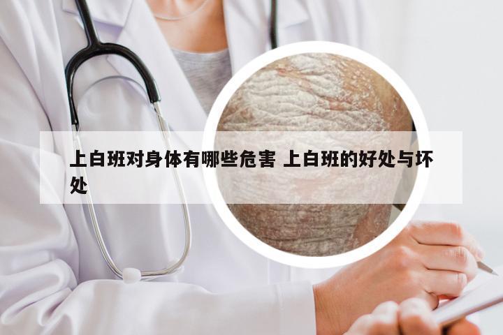 上白班对身体有哪些危害 上白班的好处与坏处