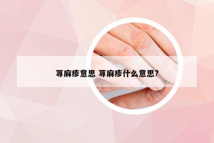 荨麻疹意思 荨麻疹什么意思?